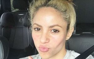 Podría Shakira quedarse calva, padece alopecia