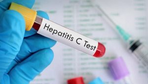 Hepatitis C, peligro silencioso