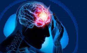 Epilepsia, patología que se debe a una actividad anormal del cerebro