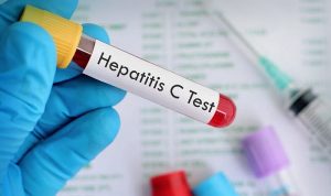 Campeche, con mínimos casos de hepatitis