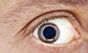 Médico recomienda prevenir el desprendimiento de retina