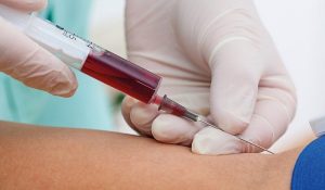 Crean prueba de sangre que detecta 7 tipos de cáncer