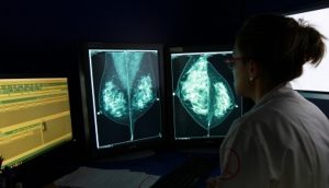 Medicina personalizada, alternativa para tratar el cáncer de mama