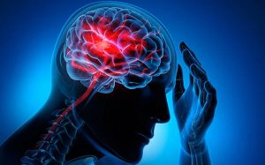 ¿Qué causa un accidente cerebrovascular?