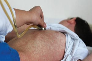Aumenta sarampión en CDMX; suman 30 casos