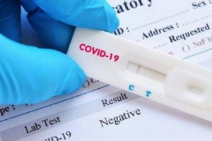 No hay pruebas rápidas certificadas para detectar coronavirus, señala Salud
