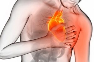 ¿Qué es un síndrome coronario agudo?
