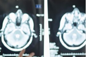Neurobiólogo logra rejuvenecer diez años su cerebro