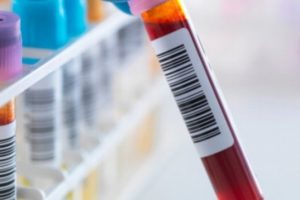 Tu tipo de sangre te puede hacer más susceptible al COVID-19: Estudio