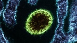 Nipah, el virus que podría desbancar al Covid-19