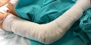 Tras más de 20 cirugías, especialistas del IMSS evitan amputar brazo de joven chiapaneca que sufrió múltiples fracturas