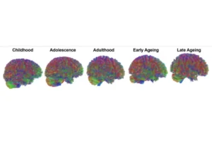 Cerebro pasa por 5 fases en la vida, que cambian a los 9, 32, 66 y 83 años