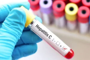 Hepatitis C puede curarse en hasta 95% de casos, pero miles de mexicanos la desconocen